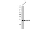 RAB11B Antibody in Western Blot (WB)