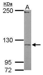 UBE3C Antibody in Western Blot (WB)