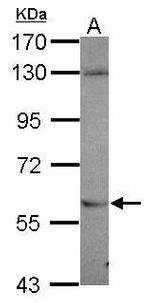 NR1 Antibody in Western Blot (WB)