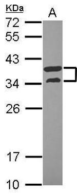 V-ATPase D Antibody in Western Blot (WB)