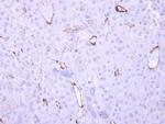 HECA Antibody in Immunohistochemistry (Paraffin) (IHC (P))