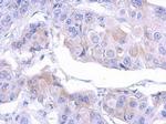 MTMR12 Antibody in Immunohistochemistry (Paraffin) (IHC (P))