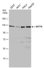 NAT10 Antibody in Western Blot (WB)