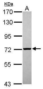 PGM2 Antibody in Western Blot (WB)