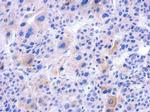 IFT122 Antibody in Immunohistochemistry (Paraffin) (IHC (P))