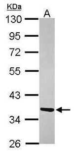 ATPAF1 Antibody in Western Blot (WB)