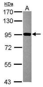 ZNF598 Antibody in Western Blot (WB)