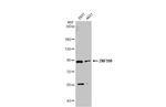 ZNF598 Antibody in Western Blot (WB)