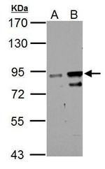 ZNF598 Antibody in Western Blot (WB)