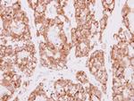 SDR16C5 Antibody in Immunohistochemistry (Paraffin) (IHC (P))