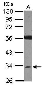 SDR16C5 Antibody in Western Blot (WB)