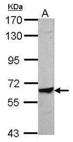 TRIM8 Antibody in Western Blot (WB)