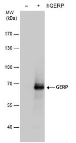 TRIM8 Antibody in Western Blot (WB)