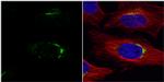 VPS33A Antibody in Immunocytochemistry (ICC/IF)