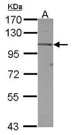 TRAK2 Antibody in Western Blot (WB)