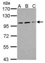 TRAK2 Antibody in Western Blot (WB)