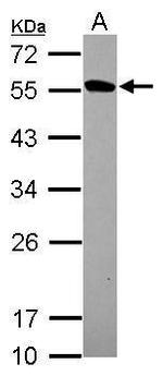 VLK Antibody in Western Blot (WB)