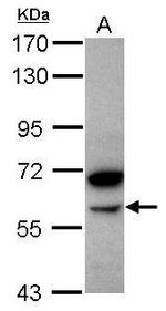 alpha Amylase 2B Antibody in Western Blot (WB)