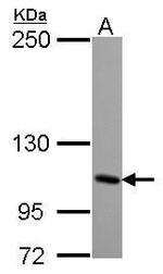 GRIK4 Antibody in Western Blot (WB)