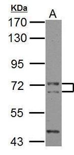 CALM Antibody in Western Blot (WB)