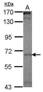 CALM Antibody in Western Blot (WB)