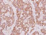 PCYOX1 Antibody in Immunohistochemistry (Paraffin) (IHC (P))