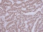 ASC1 Antibody in Immunohistochemistry (Paraffin) (IHC (P))