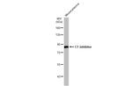 C1 inhibitor Antibody in Western Blot (WB)