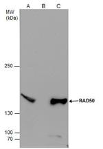 RAD50 Antibody in Immunoprecipitation (IP)