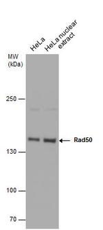 RAD50 Antibody in Western Blot (WB)