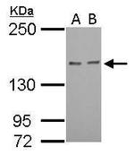 RAD50 Antibody in Western Blot (WB)