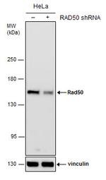 RAD50 Antibody