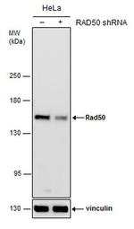 RAD50 Antibody