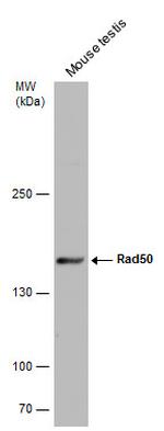 RAD50 Antibody in Western Blot (WB)