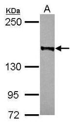 RAD50 Antibody in Western Blot (WB)