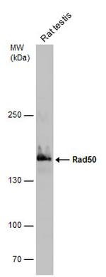 RAD50 Antibody in Western Blot (WB)