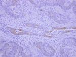 BEGAIN Antibody in Immunohistochemistry (Paraffin) (IHC (P))