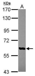 AGBL4 Antibody in Western Blot (WB)