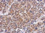 MRPS26 Antibody in Immunohistochemistry (Paraffin) (IHC (P))