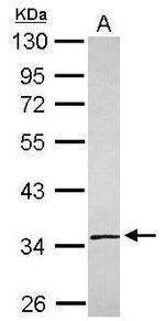 SLC25A36 Antibody in Western Blot (WB)