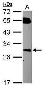 DCUN1D2 Antibody in Western Blot (WB)