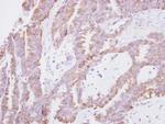 EAP30 Antibody in Immunohistochemistry (Paraffin) (IHC (P))