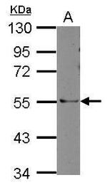 ARHGAP36 Antibody in Western Blot (WB)