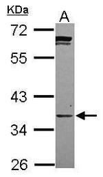 PPCS Antibody in Western Blot (WB)