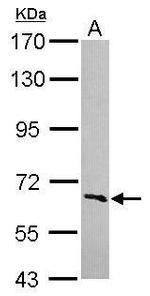 FBXW5 Antibody in Western Blot (WB)