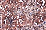 ZC3HAV1 Antibody in Immunohistochemistry (Paraffin) (IHC (P))