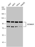 ZC3HAV1 Antibody in Western Blot (WB)