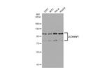 ZC3HAV1 Antibody in Western Blot (WB)