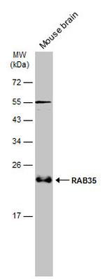 RAB35 Antibody in Western Blot (WB)