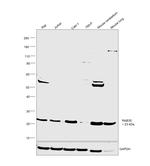 RAB35 Antibody in Western Blot (WB)